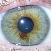 eye-right.jpg