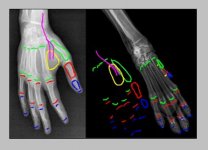 dew claws_thumbs2.jpg